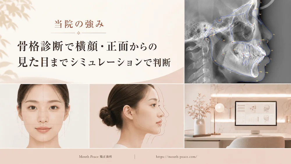 当院の強み 骨格診断で横顔・正面からの見た目までシミュレーションで判断