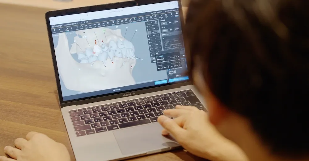 ③院長によるオーダーメイド設計で精度を高める