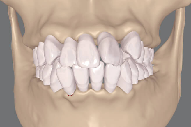 歯茎・骨の検査