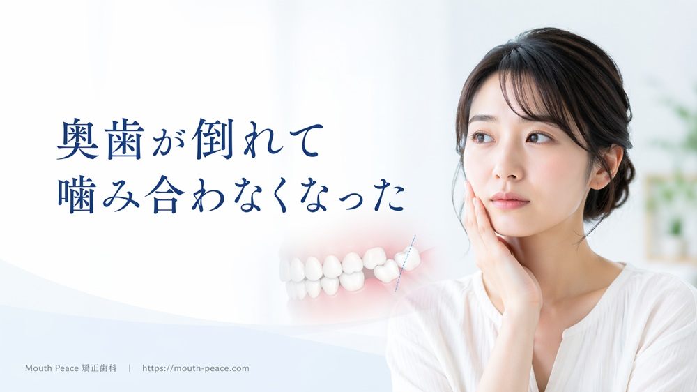 奥歯が倒れて噛み合わなくなった