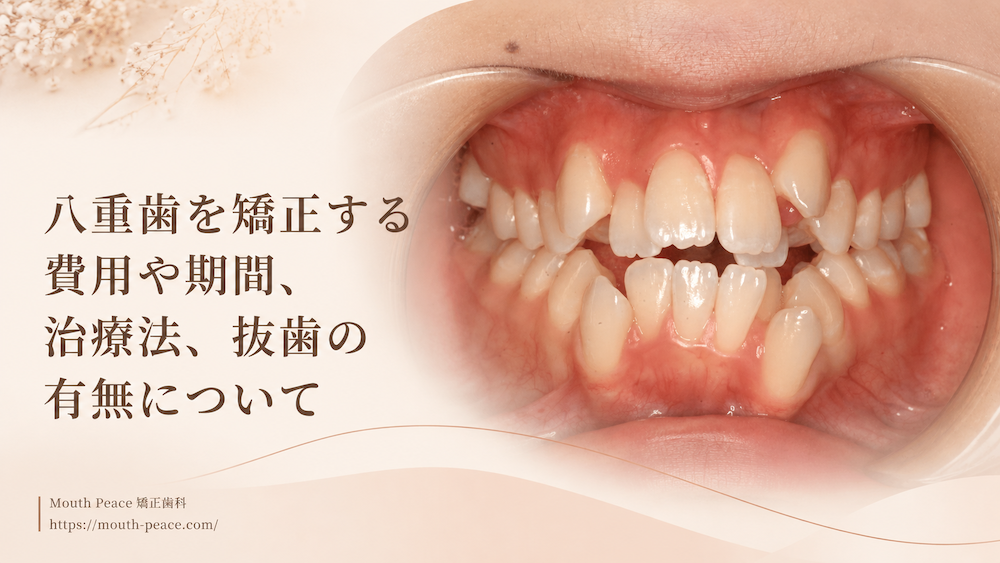 八重歯を矯正する費用や期間、治療法、抜歯の有無について