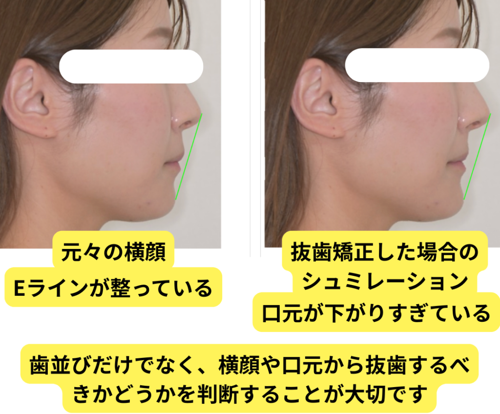 顔貌シミュレーション